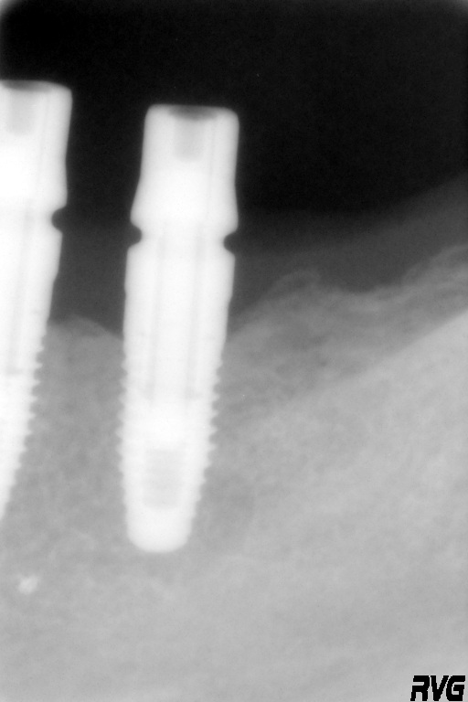  T200506163536